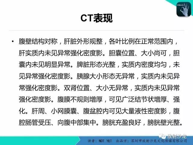 【病例】结核性腹膜炎1例CT影像表现 【病例】结核性腹膜炎1例CT影像表现