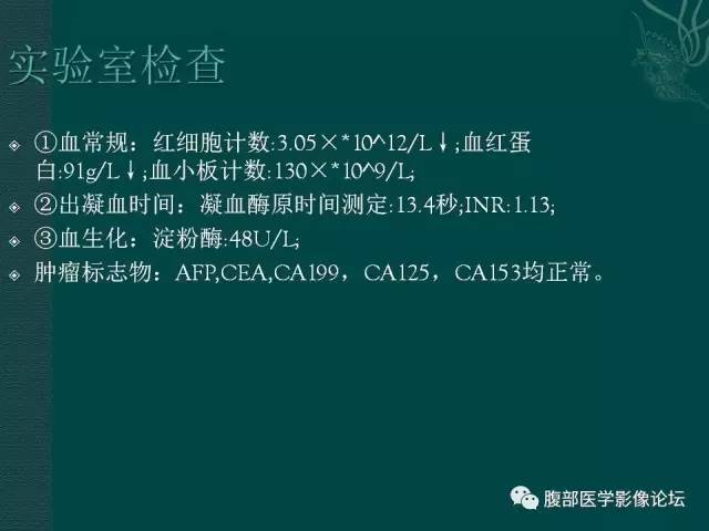 【病例】腹膜后副神经节瘤1例CT影像表现 【病例】腹膜后副神经节瘤1例CT影像表现