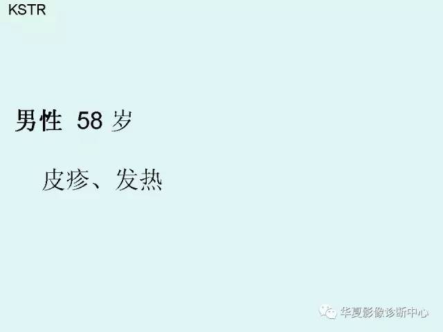 【病例】水痘性肺炎1例CT影像表现