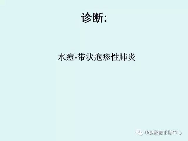 【病例】水痘性肺炎1例CT影像表现
