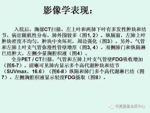 【病例】肉芽肿性血管炎1例CT影像表现