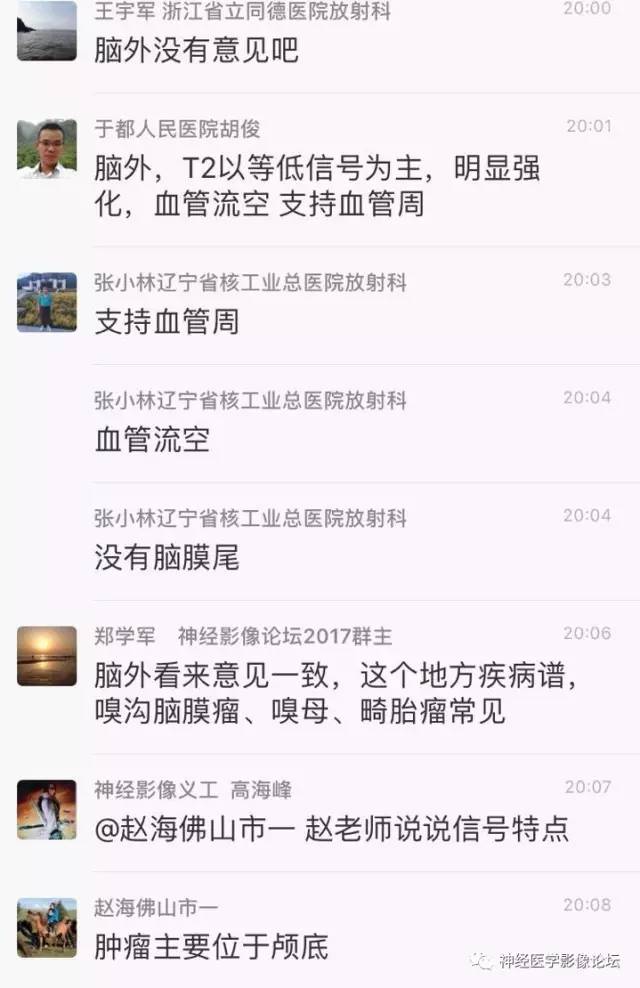【病例】血管外皮细胞瘤1例MR影像讨论