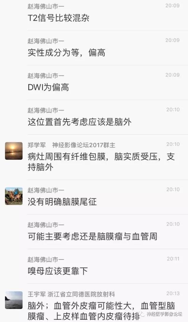 【病例】血管外皮细胞瘤1例MR影像讨论