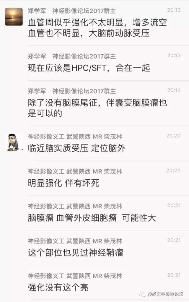 【病例】血管外皮细胞瘤1例MR影像讨论