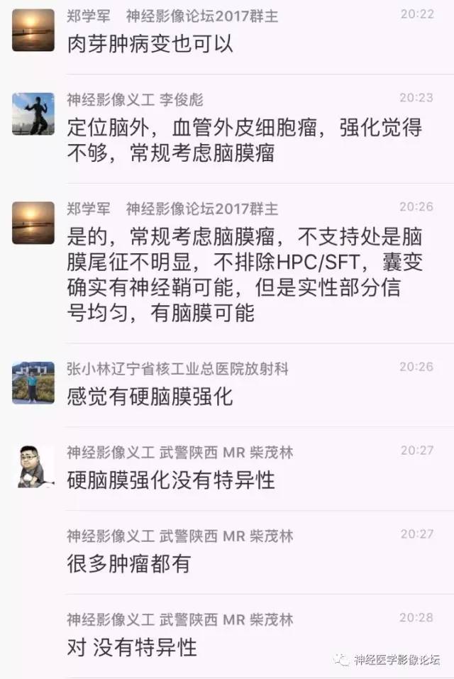 【病例】血管外皮细胞瘤1例MR影像讨论