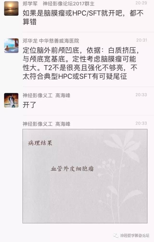 【病例】血管外皮细胞瘤1例MR影像讨论