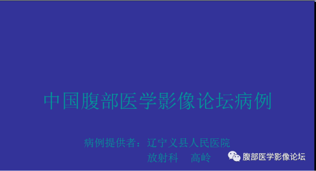 【病例】胃肠道间质瘤1例CT影像表现 【病例】胃肠道间质瘤1例CT影像表现