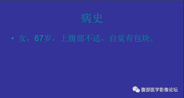 【病例】胃肠道间质瘤1例CT影像表现