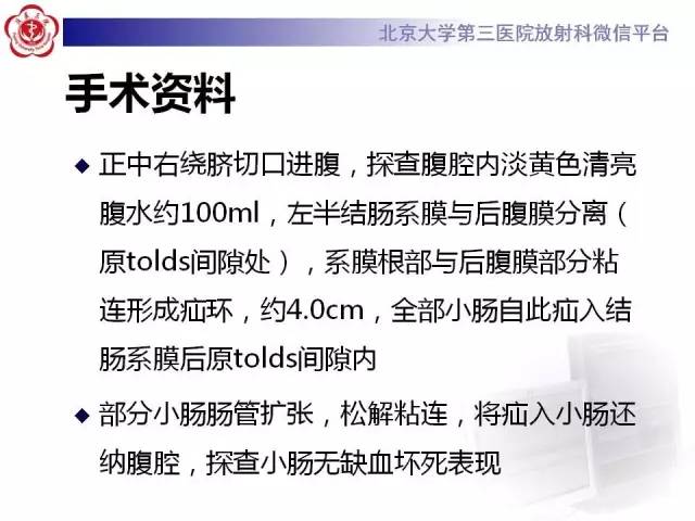 【病例】腹内疝1例CT影像表现
