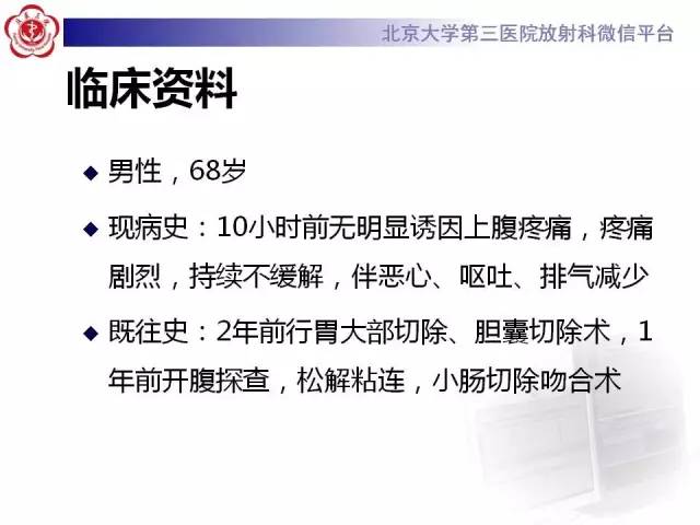 【病例】腹内疝1例CT影像表现