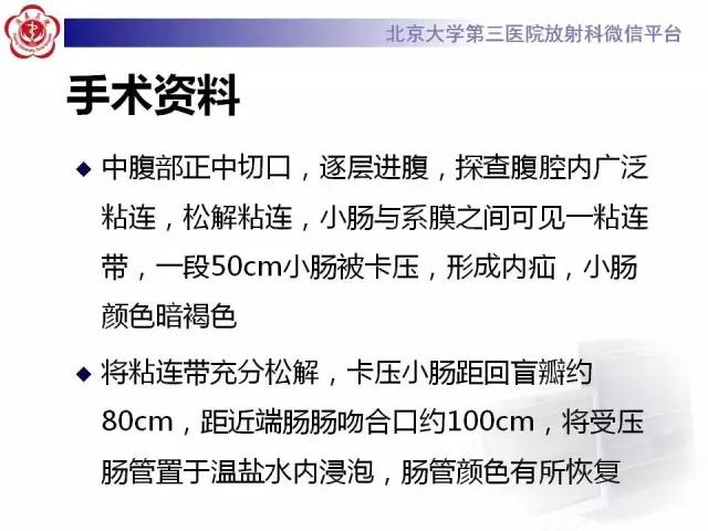 【病例】腹内疝1例CT影像表现