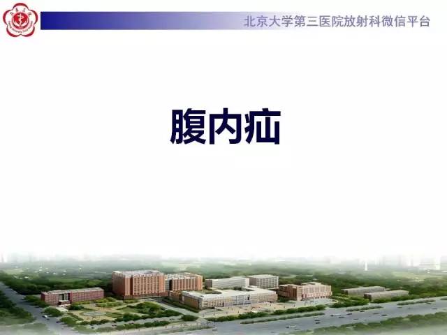 【病例】腹内疝1例CT影像表现