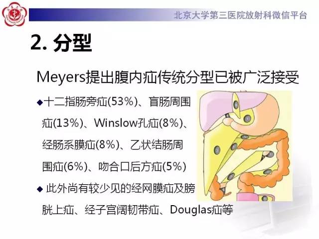 【病例】腹内疝1例CT影像表现