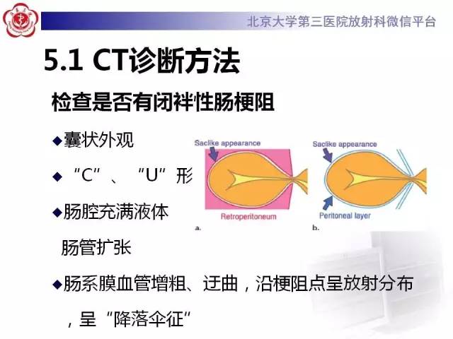 【病例】腹内疝1例CT影像表现