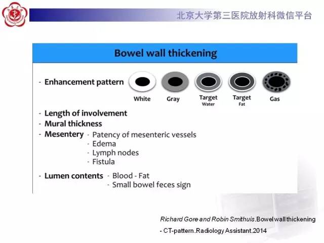 【病例】腹内疝1例CT影像表现
