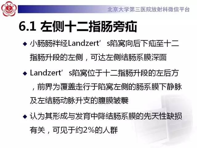 【病例】腹内疝1例CT影像表现
