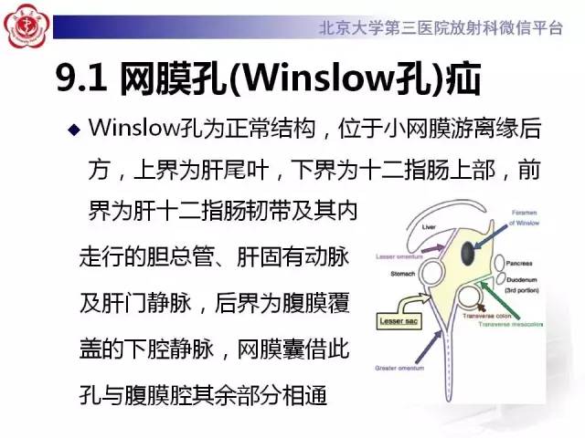 【病例】腹内疝1例CT影像表现