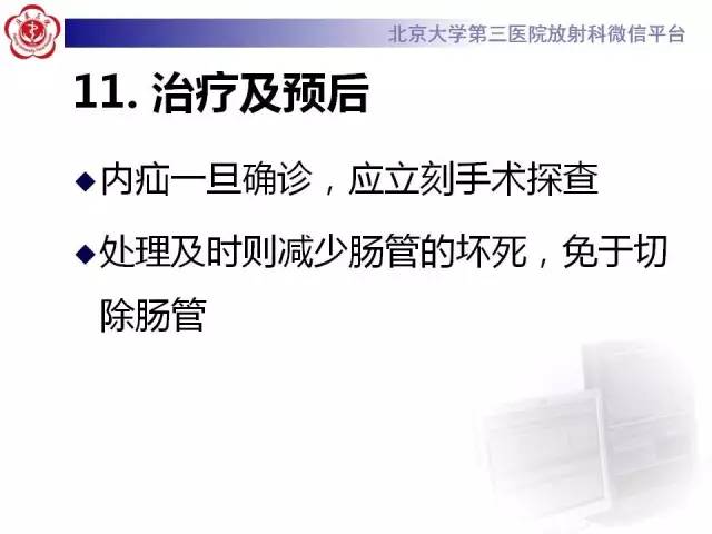 【病例】腹内疝1例CT影像表现
