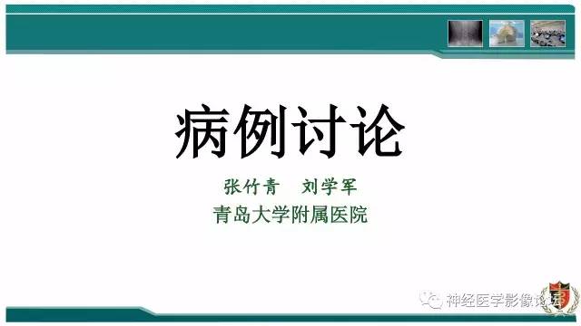 【病例】难得一见的IgG4脑炎MR