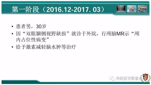 【病例】难得一见的IgG4脑炎MR