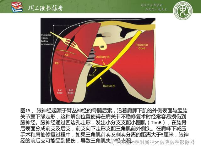 【PPT】术后肩关节MR及MR关节成像-正常与异常影像表现