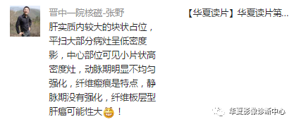 【病例】纤维板层型肝癌1例CT影像表现