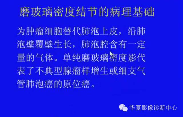 【PPT】肺癌的影像学诊断