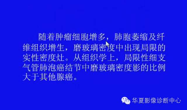 【PPT】肺癌的影像学诊断