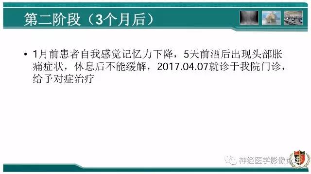 【病例】难得一见的IgG4脑炎MR