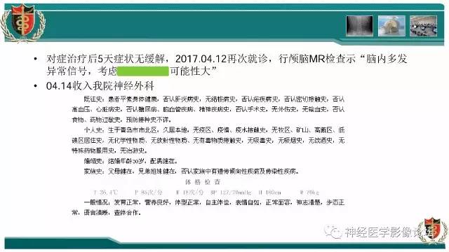 【病例】难得一见的IgG4脑炎MR