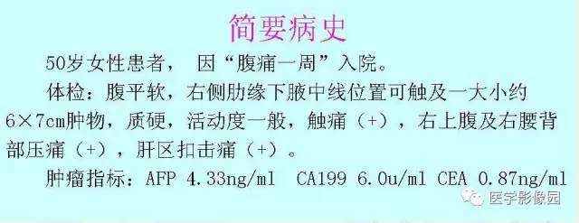 【病例】胃肠道外间质瘤1例CT