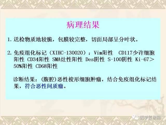 【病例】胃肠道外间质瘤1例CT