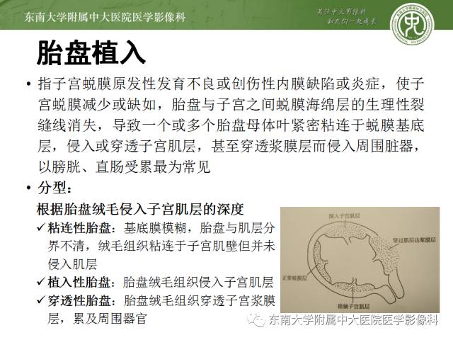 【病例】前置胎盘+胎盘植入1例MR