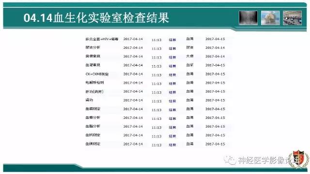 【病例】难得一见的IgG4脑炎MR