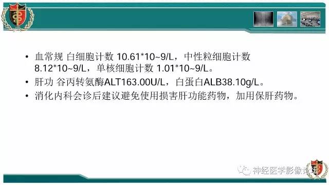 【病例】难得一见的IgG4脑炎MR