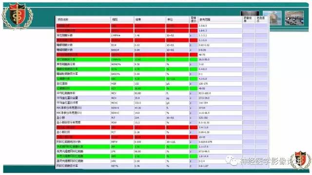 【病例】难得一见的IgG4脑炎MR