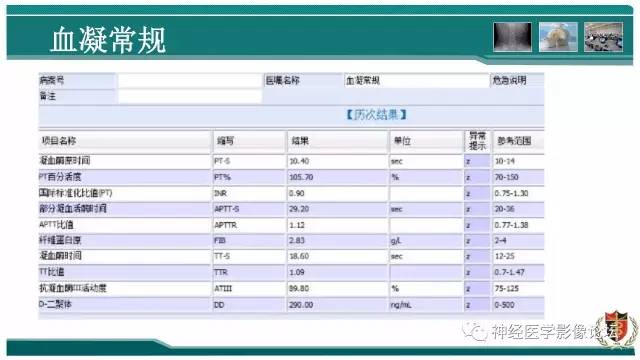 【病例】难得一见的IgG4脑炎MR