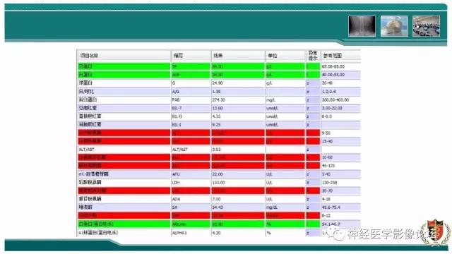 【病例】难得一见的IgG4脑炎MR