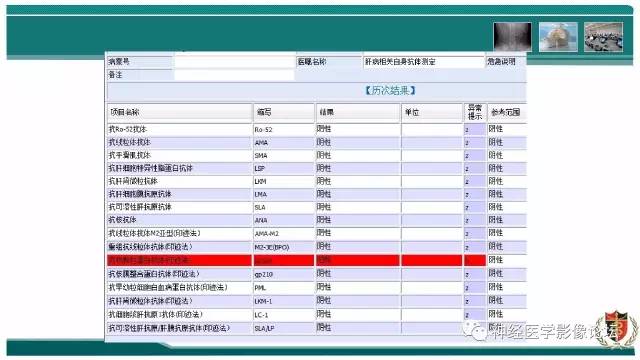 【病例】难得一见的IgG4脑炎MR
