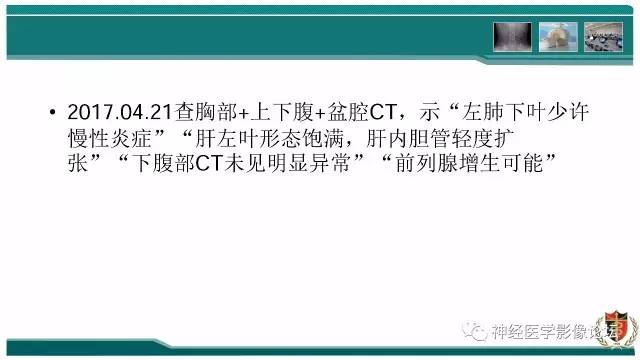 【病例】难得一见的IgG4脑炎MR