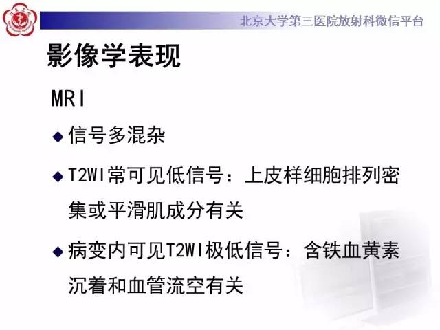 【病例】左肾上皮样血管平滑肌脂肪瘤1例CT及MR