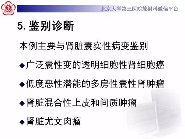 【病例】左肾上皮样血管平滑肌脂肪瘤1例CT及MR