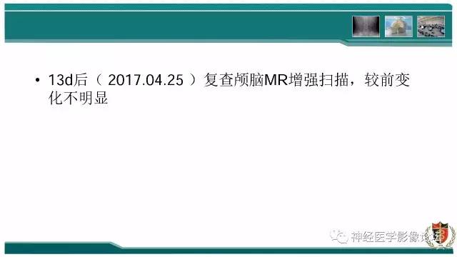 【病例】难得一见的IgG4脑炎MR