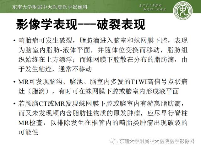 【病例】颅内畸胎瘤破裂1例CT及MR