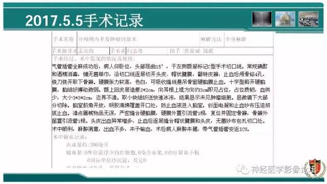 【病例】难得一见的IgG4脑炎MR