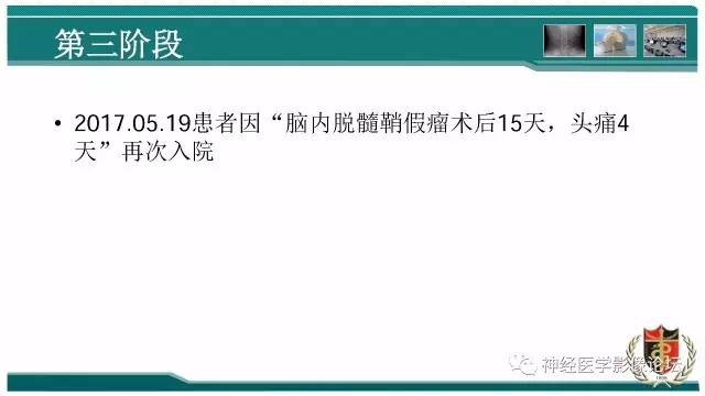 【病例】难得一见的IgG4脑炎MR