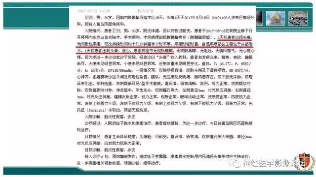 【病例】难得一见的IgG4脑炎MR