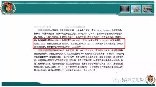 【病例】难得一见的IgG4脑炎MR