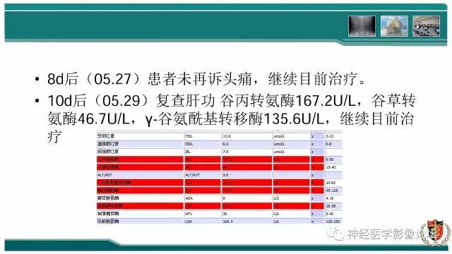 【病例】难得一见的IgG4脑炎MR
