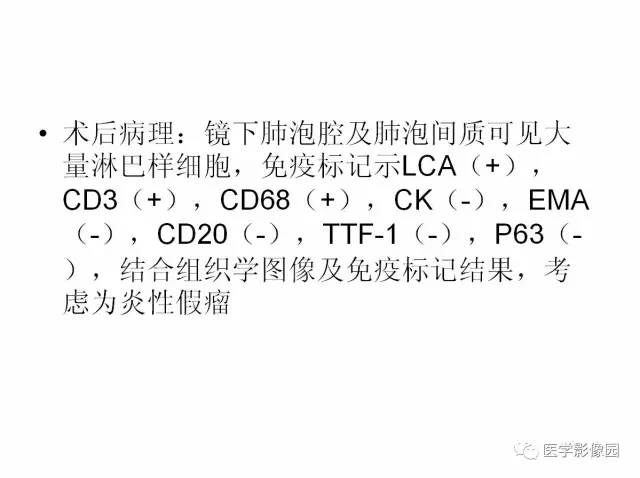 【病例】肺部炎性假瘤1例CT影像表现